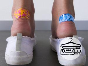 علت تاول پا چیست و چگونه آن را درمان کنیم؟