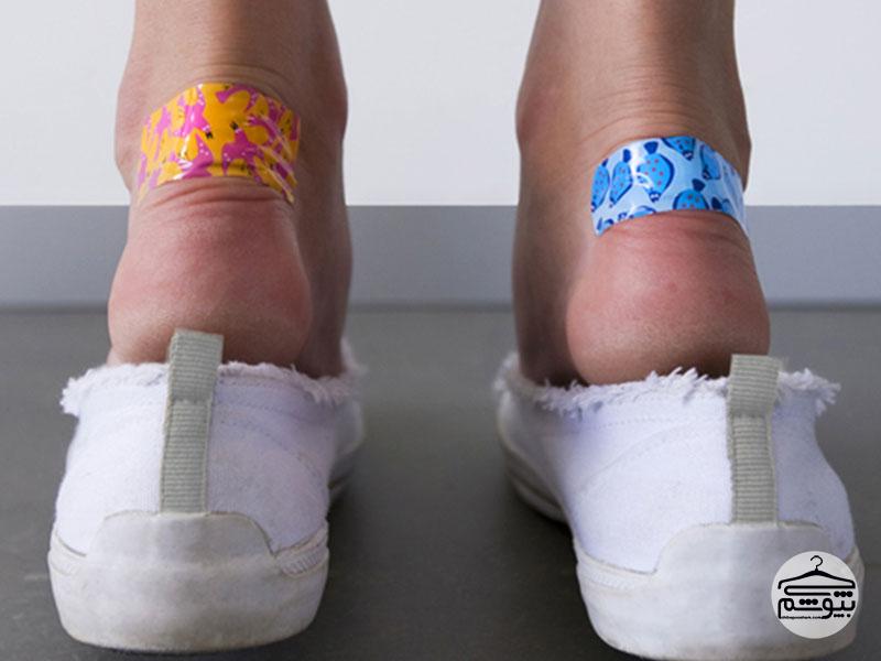 علت تاول پا چیست و چگونه آن را درمان کنیم؟