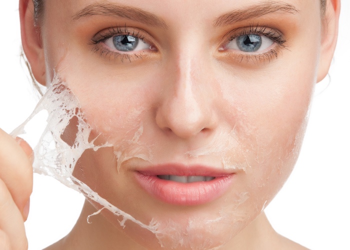 راه‌های درمان پوست خشک