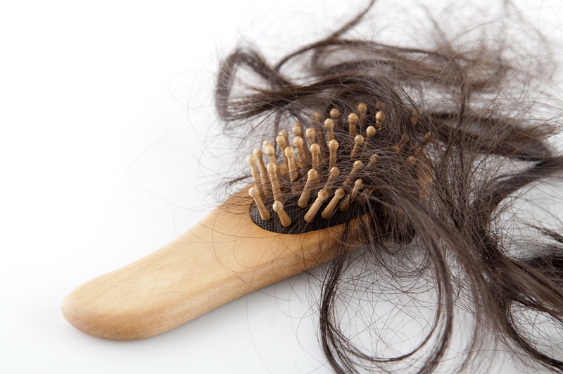 ۵ دلیل اصلی ریزش مو در زنان
