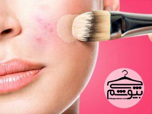 چگونه جوش‌های صورت را با آرایش پوشش دهیم؟