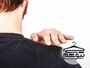 معرفی بهترین شامپو ضد شوره