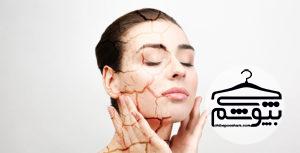 خشکی پوست؛ علل و راه‌های درمان با ماسک‎های خانگی