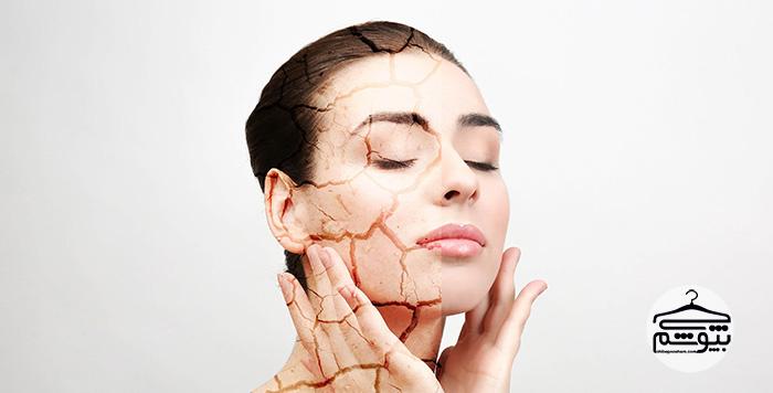 خشکی پوست؛ علل و راه‌های درمان با ماسک‎های خانگی