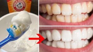چند راهکار ساده برای سفید کردن دندان‌ها در خانه؛ تاثیرات را باور نمی‌کنید!