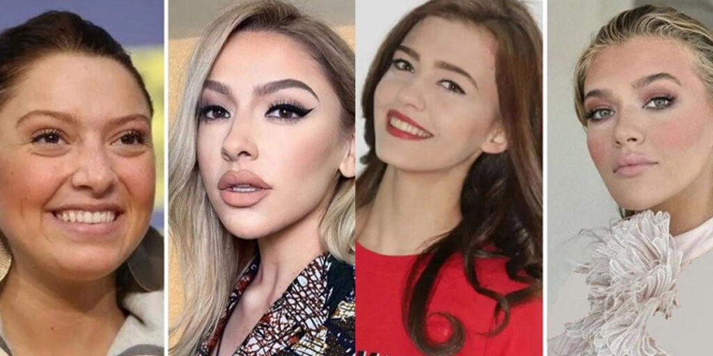 تصاویری که ثابت می‌کنند زنان مشهور ترک فقط با جراحی پلاستیک زیبا شده‌اند!