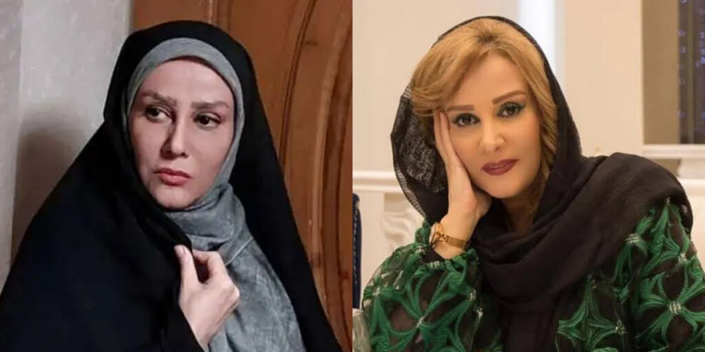 تغییر چهره این بازیگر ایرانی سوژه شد؛ همه مدل جراحی زیبایی روی صورتش انجام داده!