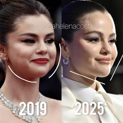 زاویه‌دار شدن صورت سلینا گومز