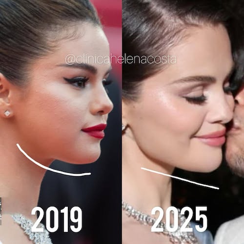 زاویه‌دار شدن صورت سلینا گومز