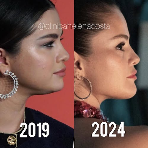 زاویه‌دار شدن صورت سلینا گومز