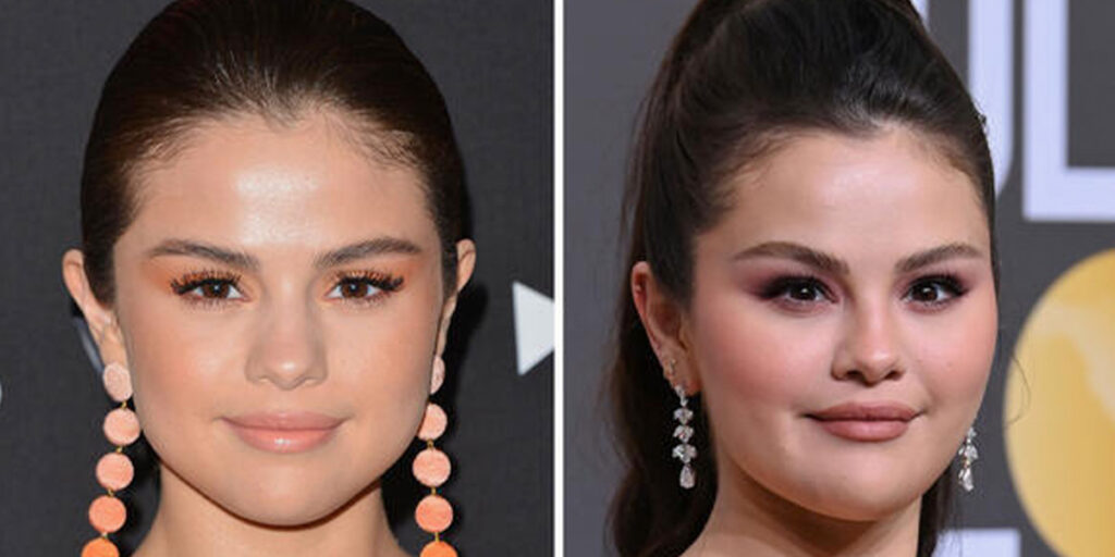 تصاویری که آبروی سلینا گومز را به باد دادند؛ پس جراحی بوده!