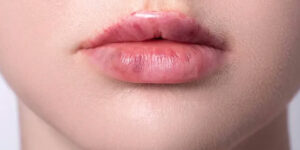 راهکارهایی برای از بین بردن تیرگی لب‌ها در خانه؛ سیگاری‌ها بخوانند