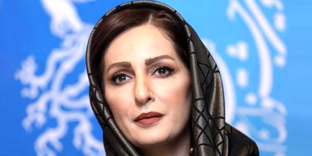 شقایق دهقان با صورتش چه کرده که هرروز زیباتر می‌شود؟