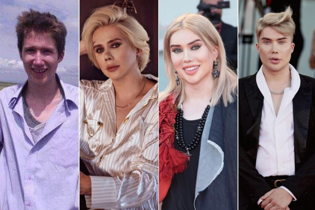 مرد انگلیسی با ۳۲ جراحی پلاستیک