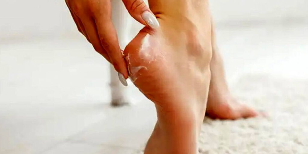 ۵ کرم پا که برای ترک‌های شما معجزه می‌کنند