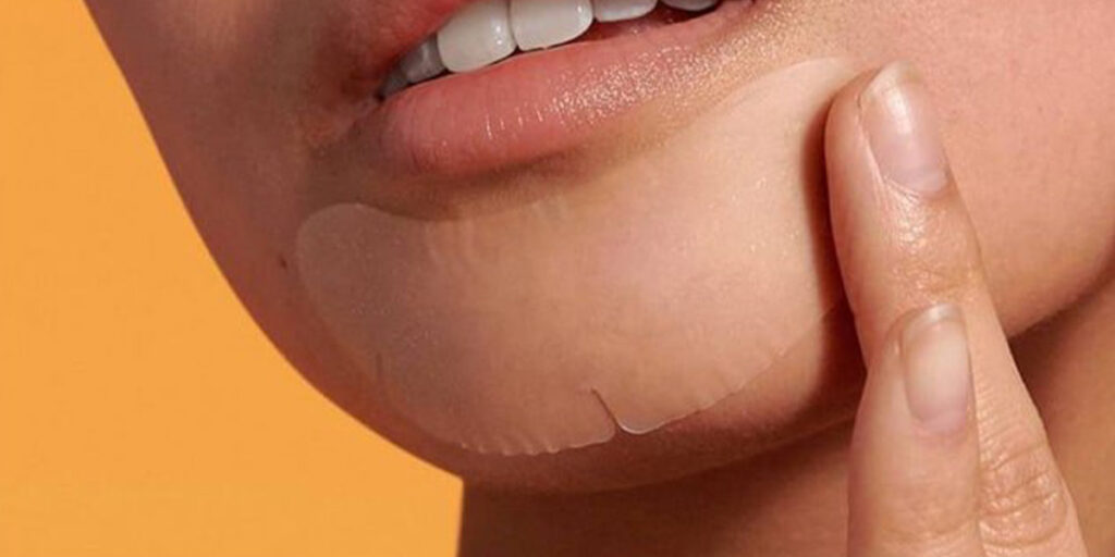 علت جوش چانه و درمان آن