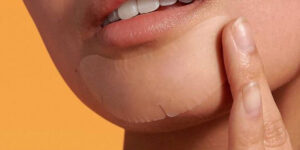 علت جوش چانه چیست و چگونه می‌توانیم از آن خلاص شویم؟