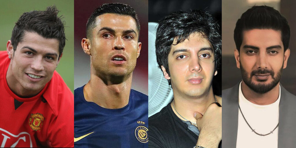 وقتی پول وارد می‌شود و زیبایی می‌آورد؛ مقایسه چهره قدیم و جدید ستاره‌های مشهور