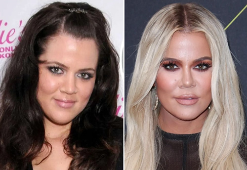 تغییرات ظاهری خانواده کارداشیان-جنر