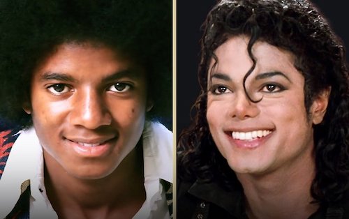 قبل و بعد سلبریتی‌ها