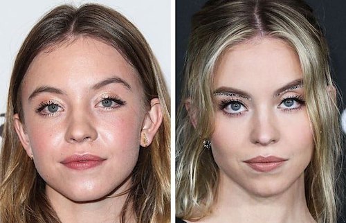 قبل و بعد سلبریتی‌ها