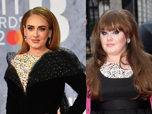 قبل و بعد سلبریتی‌ها