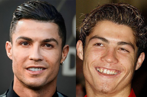 قبل و بعد سلبریتی‌ها