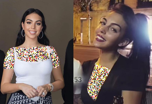 قبل و بعد سلبریتی‌ها