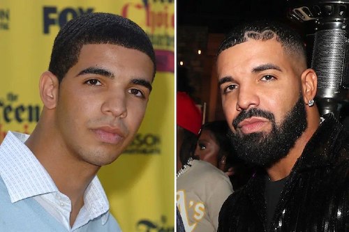 قبل و بعد سلبریتی‌ها