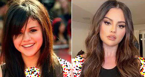 قبل و بعد سلبریتی‌ها