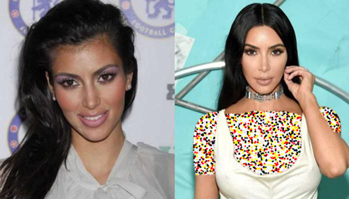 قبل و بعد سلبریتی‌ها