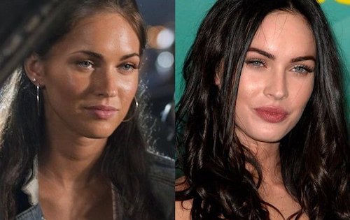 قبل و بعد سلبریتی‌ها