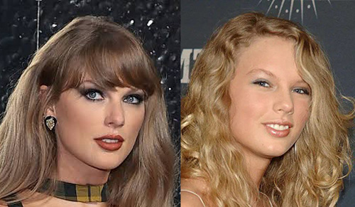 قبل و بعد سلبریتی‌ها