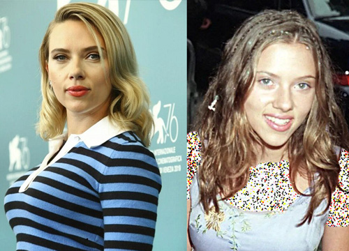 قبل و بعد سلبریتی‌ها