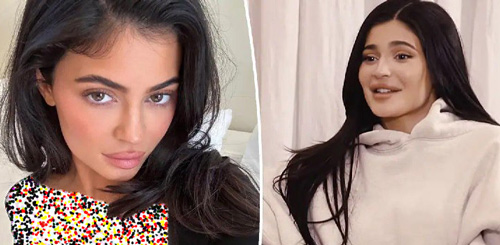 قبل و بعد سلبریتی‌ها