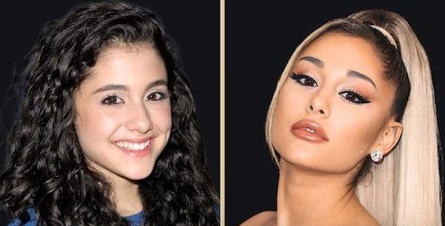 قبل و بعد سلبریتی‌ها