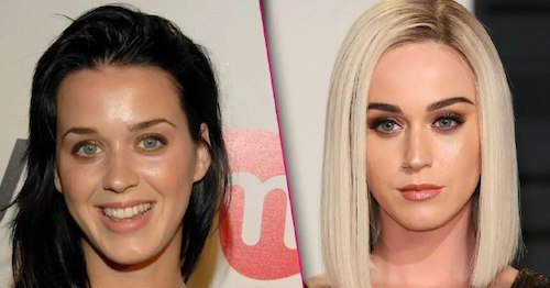 قبل و بعد سلبریتی‌ها