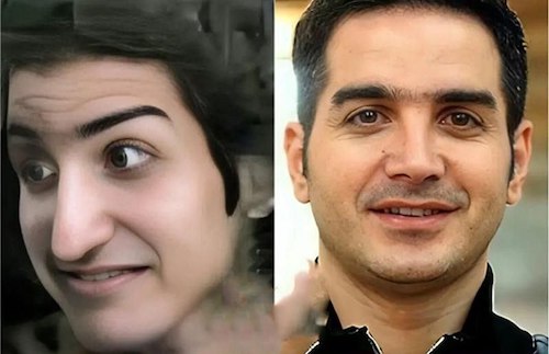 قبل و بعد سلبریتی‌ها