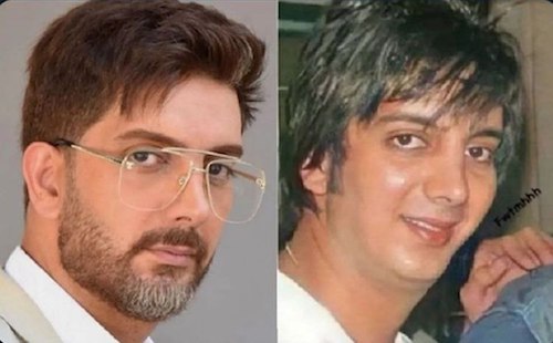 قبل و بعد سلبریتی‌ها