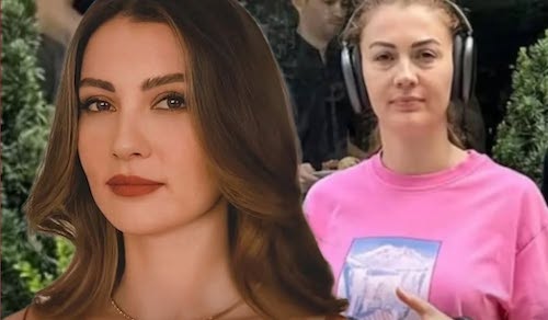 صورت بدون‌ آرایش بورجو اوزبرک