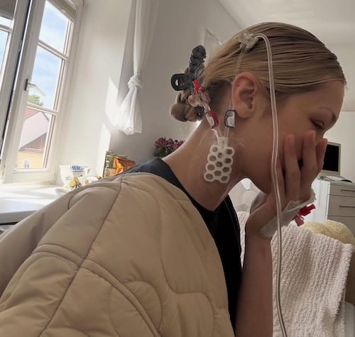 جلب توجه بلا حدید