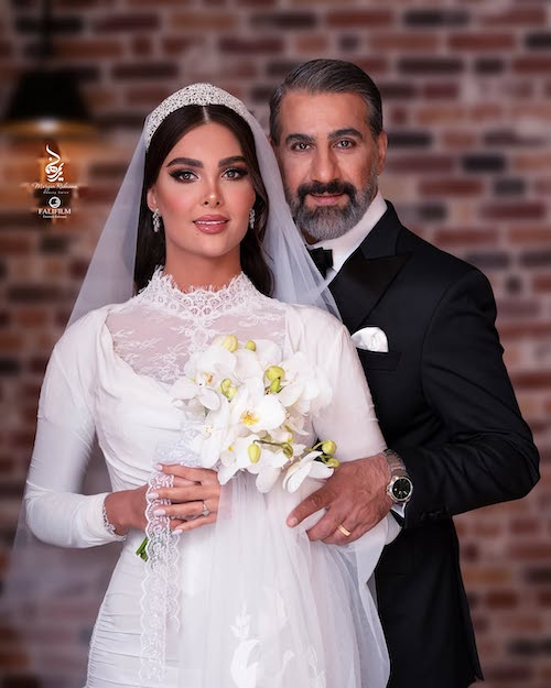 لباس عروس الناز