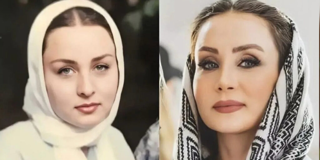 تمام تغییراتی که حدیث فولادوند روی صورتش داده و آن‌ها را گردن نمی‌گیرد!