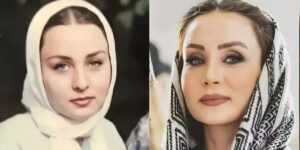 تمام تغییراتی که حدیث فولادوند روی صورتش داده و آن‌ها را گردن نمی‌گیرد!