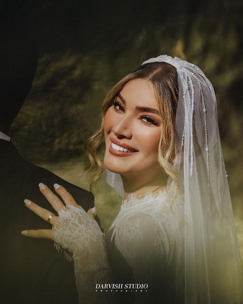 مقایسه ظاهر متین ستوده در ازدواج اول و دوم