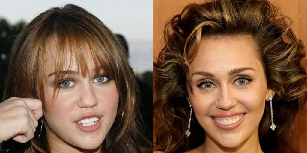 تغییر چهره مایلی سایرس و انتقادات