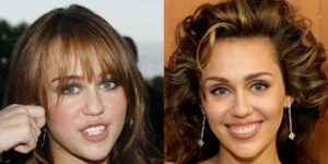 جراحی زیبایی خواننده مشهور آمریکا کاملا به ضررش تمام شد؛ آنهمه زیبایی کجا رفت؟