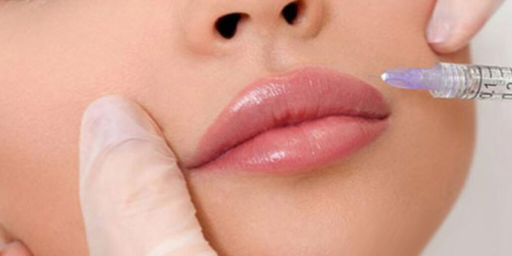 چند سی سی ژل لب برای لب‌های شما کافیست؟ این تصویر پاسخ می‌دهد