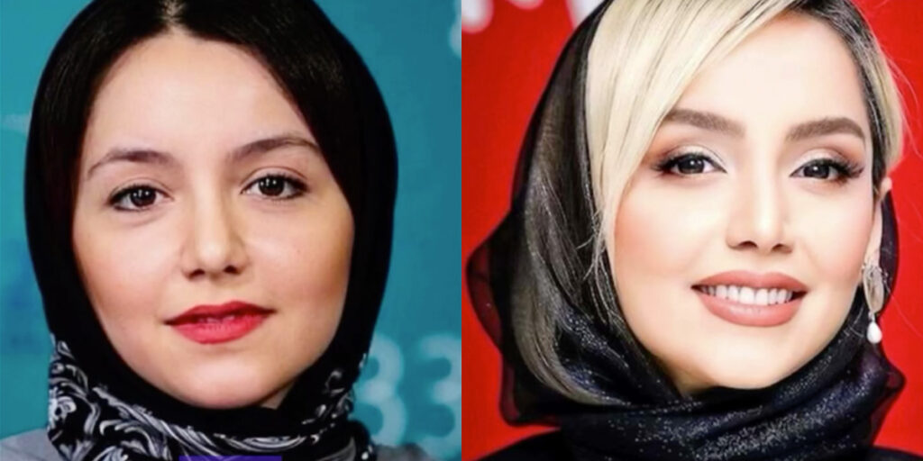 تغییرات چهره نازنین بیاتی از گذشته تا امروز؛ ستاره محبوب دقیقا چه جراحی‌هایی انجام داده؟