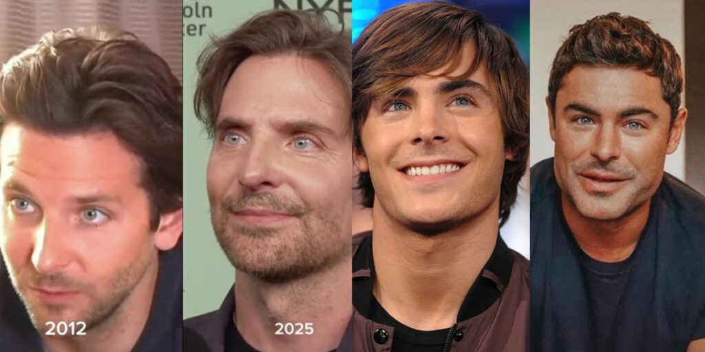 مردان مشهوری که با تزریقات زیبایی طرفدارانشان را خشمگین کردند